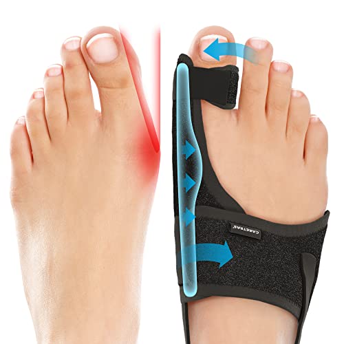 Bunion Corrector for Men & Women - Toe Straightener with Adjustable Support