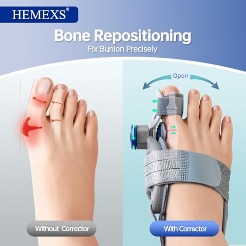 Bunion Corrector for Women & Men Grey 1 Pack - Adjustable Toe Straightener for Big Toe Alignment