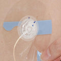 60 Pack Universal Adhesive Patches for CGM & Insulin Pumps, Waterproof Skin-Friendly Covers