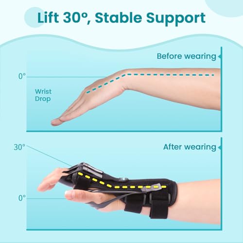 Radial Nerve Palsy Wrist Support Brace for Stroke Recovery - Black