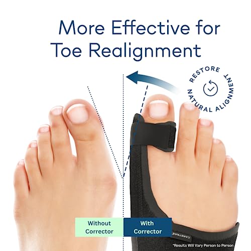Bunion Corrector for Men & Women - Toe Straightener with Adjustable Support