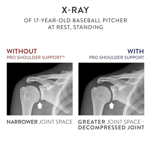 OPTP PRO Shoulder Support Standard Version Gray Rotator Cuff Pain Recovery Sling