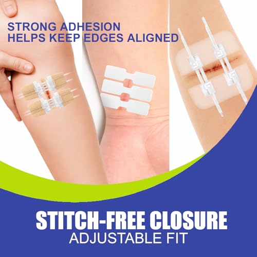 Wound Closure Strips for Skin 40 Pack Waterproof & Breathable First Aid