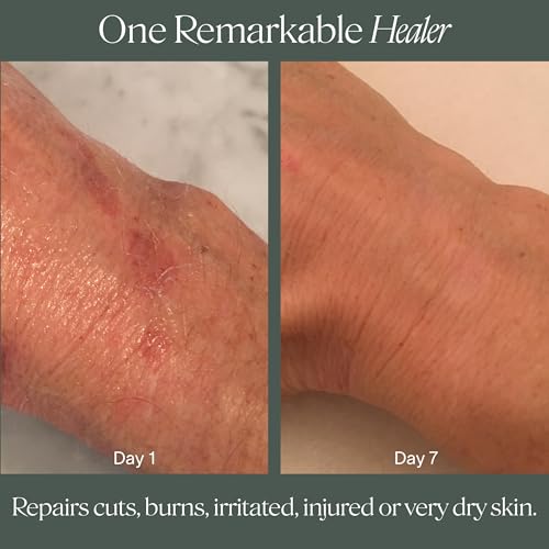 Doctor Rogers Restore Healing Balm 4oz - Multi-Purpose Skin Moisturizer & Ointment