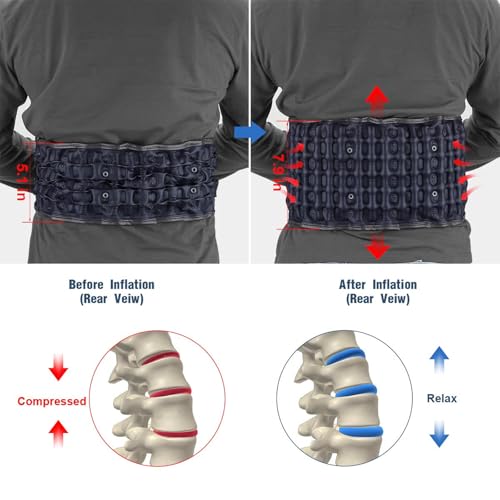 HONGJING Blue Decompression Back Support Belt for Lower Back Pain Relief