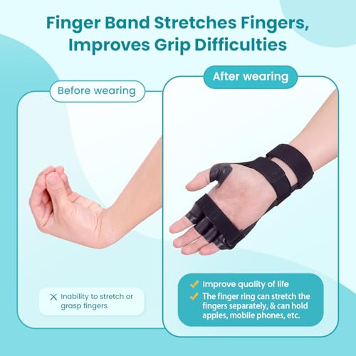 Radial Nerve Palsy Wrist Support Brace for Stroke Recovery - Black