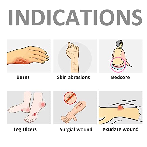 Silver Calcium Alginate Wound Dressings - Absorbent Painless Treatment for Burns Ulcers 6 Pack