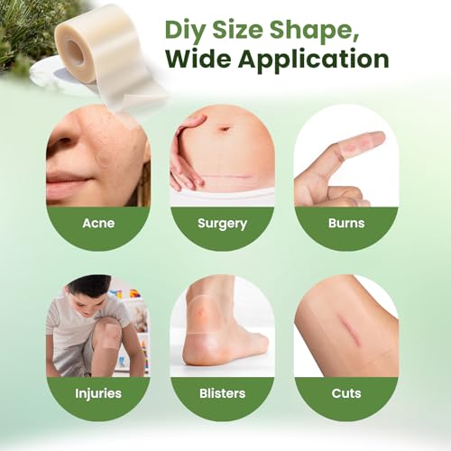 Tea Tree Hydrocolloid Roll Bandages - Cut-to-Size, Waterproof, 2.56 x 16.4 ft