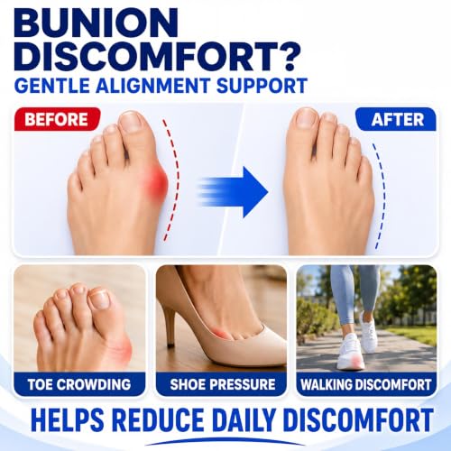 Bunion Corrector Kit with Toe Separator Arch Support Hot Cold Gel Pad - Variation 2