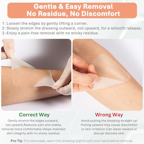 Hydrocolloid Wound Dressing 4x4 Inch Pack of 20 Waterproof Skin Patches for Faster Healing