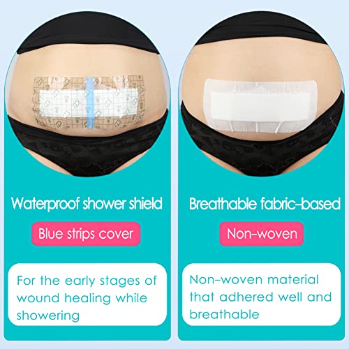 Breathable 4x10 Inch C-Section Incision Bandage Pack of 10 - Post Surgery Wound Cover