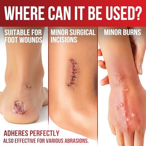Silicone Foam Dressing with Adhesive Border - 4 x 4 Inches, Pack of 20 Waterproof Wound Bandages