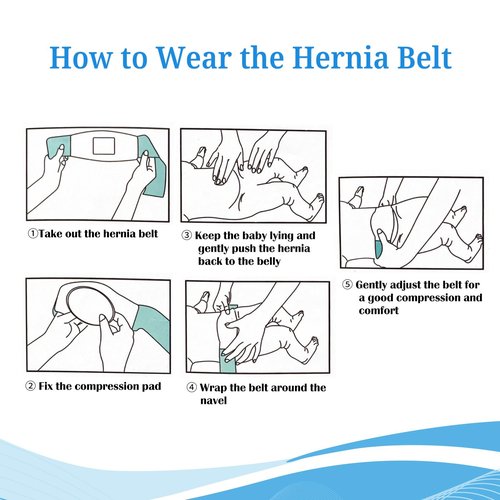 S Baby Belly Band Umbilical Hernia Belt | Belly Button Band Navel Truss Wrap for Newborn/Infant - Soft, Skin-friendly, Adjustable
