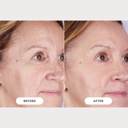 CurrentBody Skin LED Light Therapy Mask - Series 2 for Radiant Skin & Anti-Aging Benefits