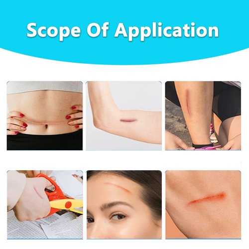 10PCS Wound Closure Strips, Butterfly Bandages Emergency Laceration Closure Kit Repair Wounds Without Stitches, Quick Clot Zip Stitch Wound Closures Device
