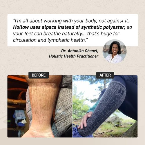 HOLLOW Alpaca Wide Compression Circulation Socks for Men and Women, Moisture Wicking Alpaca Wool Socks for Hiking, Running, Temperature Regulating & Comfortable (Medium, Grey)