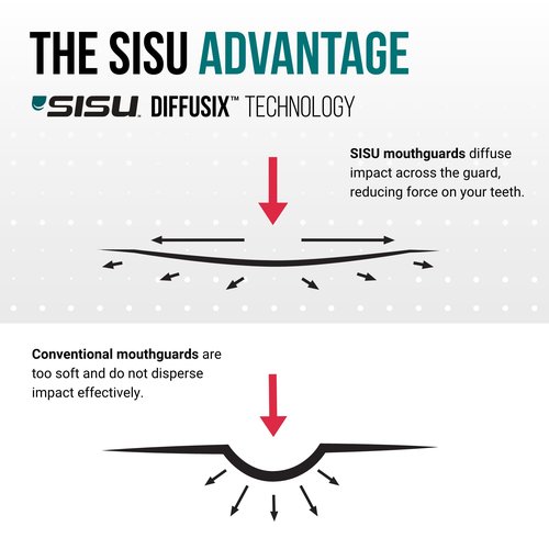 SISU Max Mouthguard, Charcoal Black - 50% Stronger, Maximum Protection for Rugby, MMA, Boxing, Lacrosse, Football, Hockey, High-Impact Sports - Adult Fit, Remoldable Up to 20 Times, Works for Braces