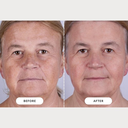 CurrentBody Skin LED Light Therapy Mask - Series 2 for Radiant Skin & Anti-Aging Benefits