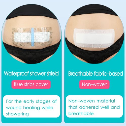 10 Pcs C-Section Incision Adhesive Island Dressing 4"x10" Bandage Breathable Bordered Gauze Pads for Post Abdominal Surgery Hysterectomy Tummy Tuck Recovery Wounds Cover Women Patients