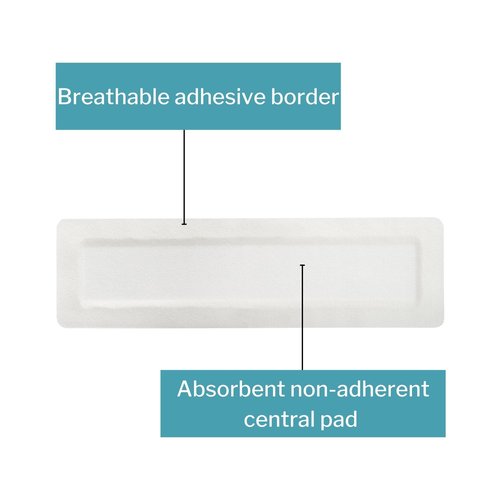 McKesson Island Dressings, Sterile, Dimension 4 in x 14 in, Pad 2 in x 12 in, 25 Count, 1 Pack