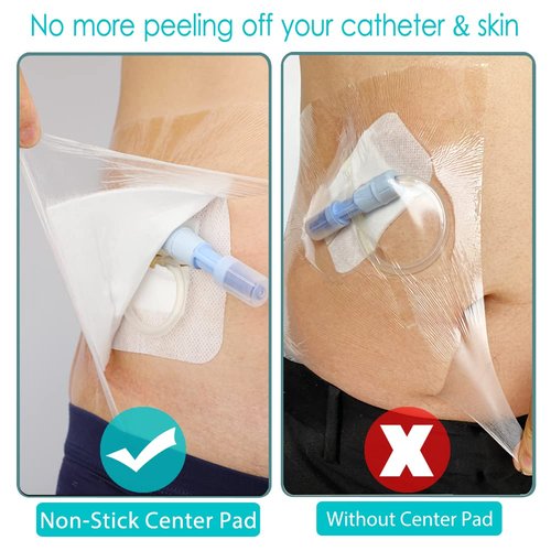 Waterproof Shower Cover Shields Dialysis Port Picc Line Chest Catheter PD Peritoneal Dialysis Chemo Non-Stick Center Pad for Feeding Tube Peg G-Tube Patient Bandage Protector, 10"x10"(Pack of 25)