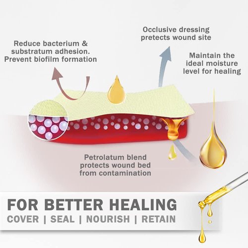 EVERLIT Xeroform Petrolatum Dressing | Sterile, Non-Adherent Occlusive Fine Mesh Gauze Pad | Non-Toxic, Gentle Patch for Burns, Laceration, Surgical Incisions & Skin Grafts (2" x 2" | Pack of 25)