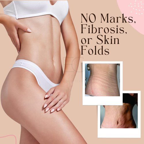 Elite Compression Tummy Tuck Lipo Foam Shapewear Board | Post Surgery Liposuction Recovery Abdominal Boards For Women | Tabla abdominal Post Cirugía