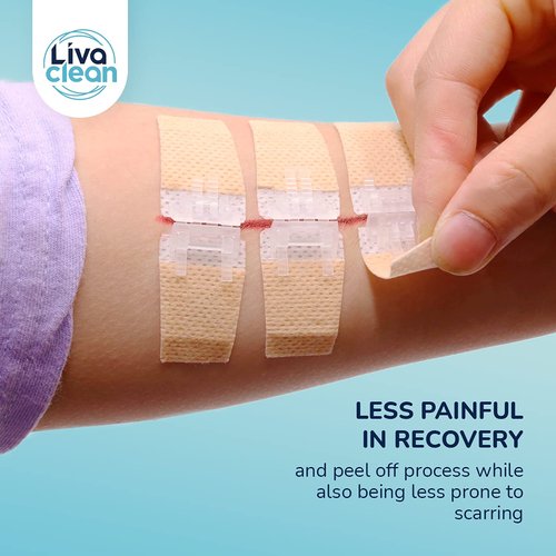 (6 CT) 1 X 3.7” Wound Closure Strips - Zip Stitch Wound Closure Kit - Butterfly Kit Device Zip Tie Skin Closuing Butterfly Bandaids Adhesive Injury-Closing Glue Steri Strips Bandages Sutures
