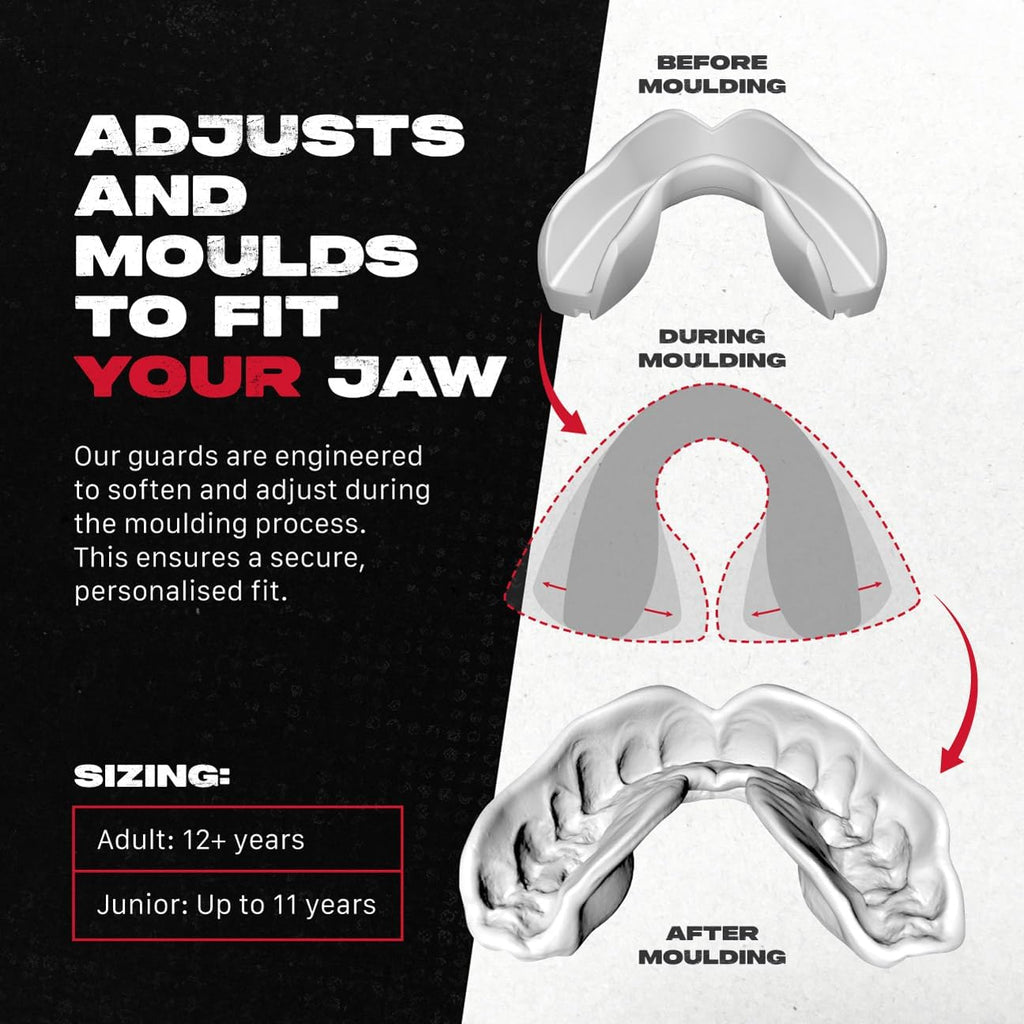 SAFEJAWZ Mouth Guard - Remoldable Upper & Lower Protection for Braces | Ideal for Contact Sports (Transparent)
