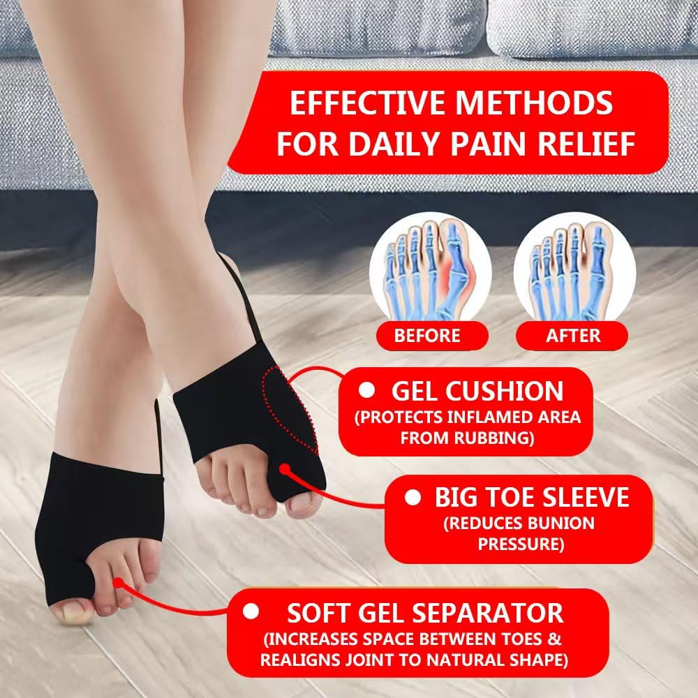 ZXCFBEA 2PCS Bunion Corrector for Women & Men,Big Toe Separators-Bunion Splint-Bunion Pads-Hammer Toes Straightener-Toes Spacers Pain Relief, Comfortable & Breathable for Day/Night (Black)