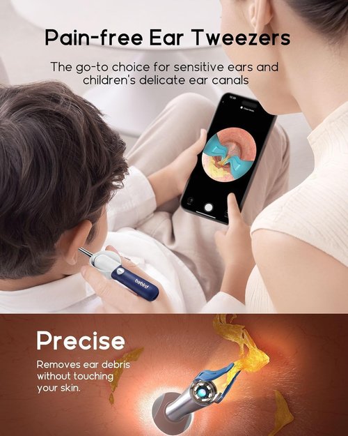 Bebird Earsight Plus D39R Ear Wax Removal Tool - Flexible Camera Otoscope & Family Cleaning Kit