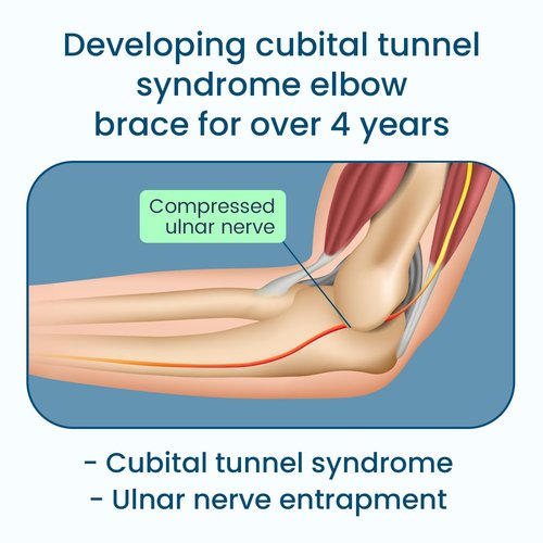 Microeagle Cubital Tunnel Syndrome Elbow Brace Splint For Ulnar Nerve Entrapment