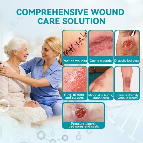 Dimora Calcium Alginate Wound Dressing - Soft, Highly Absorbent 4'' x 4'' Sterile Pads | 10 Non-Stick Gauze Patches