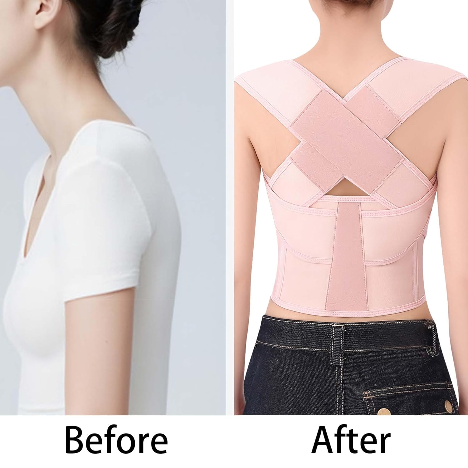 Skiennix Posture Corrector - Adjustable Full Back Support Brace for Men & Women | Hunchback Relief, Medium Pink