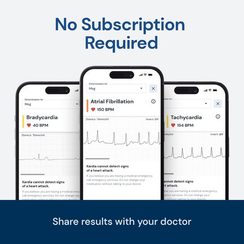 KardiaMobile EKG Monitor - FDA-Cleared Personal Heart Monitor | Detects AFib & Arrhythmias, Pocket Size