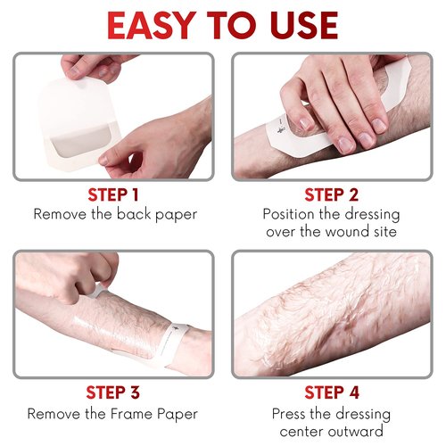 Transparent Film Dressing 8" x 12" (10 Pack) – Waterproof Adhesive Wound Bandages for Post-Surgical Shower, IV Shield, Tattoo Aftercare, Clear Breathable Dressing Patches by HEALQU