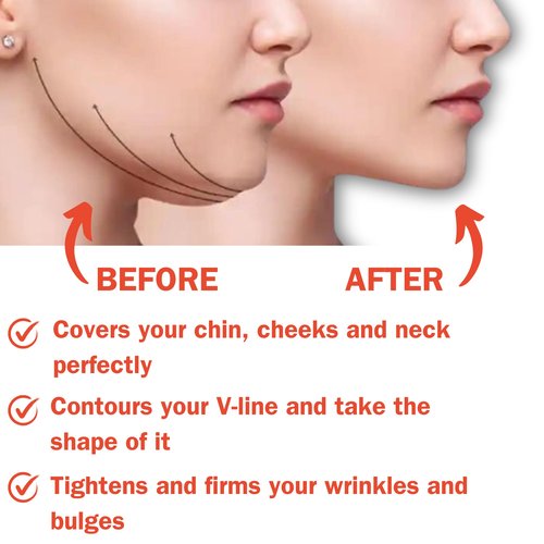 Post Surgical Chin Strap Bandage for Women - Neck and Chin Compression Garment Wrap - Chin Lipo Compression Garment, Jowl Tightening, Chin Lifting (Large- Black)