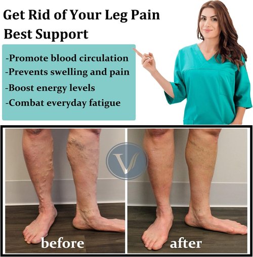 ACTINPUT Copper Compression Socks - 4 Pairs for Men & Women | Ultimate Support for Nurses, Running & Travel
