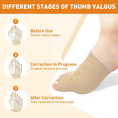 CKOWAJN 4Pcs Bunion Corrector for Women Big Toe, Big Toe Separators Non-Slip & Washable, Toes Straightener, Hallux Valgus Pain Relief Bunions Correction with Splint & Pads (Baige)