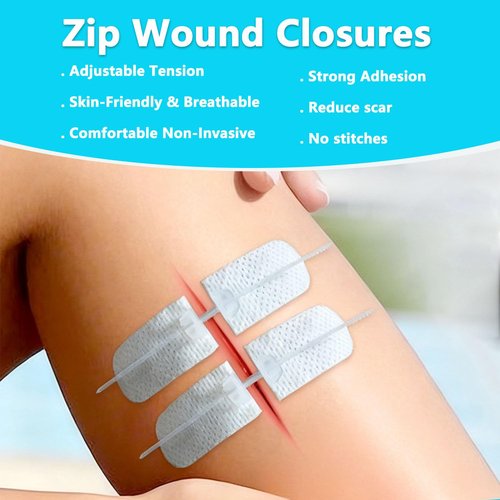 10PCS Wound Closure Strips, Butterfly Bandages Emergency Laceration Closure Kit Repair Wounds Without Stitches, Quick Clot Zip Stitch Wound Closures Device