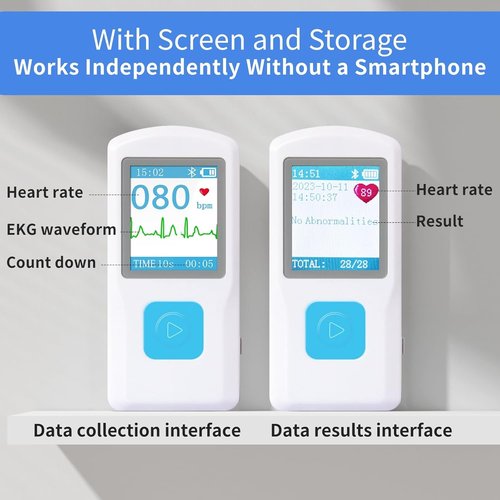 EKG Monitor Device - Portable Heart Rate Monitor with LCD Screen | Instant Results in 30 Seconds