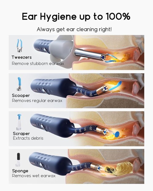 Bebird Earsight Plus D39R Ear Wax Removal Tool - Flexible Camera Otoscope & Family Cleaning Kit