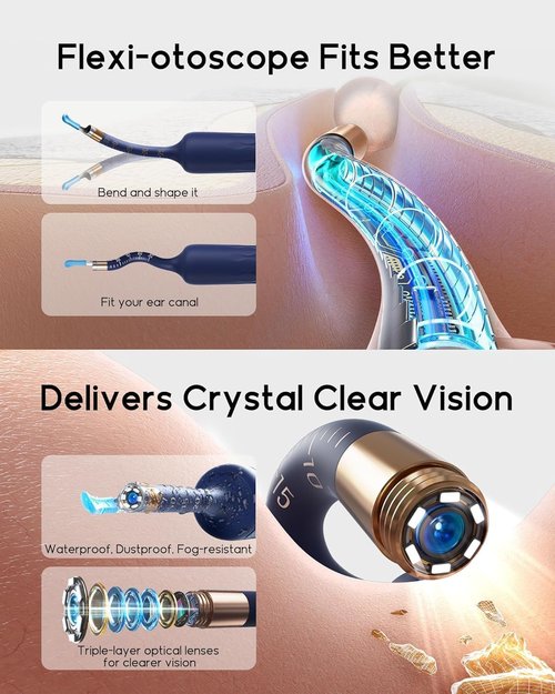 Bebird Earsight Plus D39R Ear Wax Removal Tool - Flexible Camera Otoscope & Family Cleaning Kit
