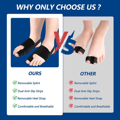 TISMOD 2 Pack Bunion Corrector,Big Toe Straightener for Women & Men, Adjustable, Breathable Splint for Hallux Valgus Pain Reduce，,Fits Left/Right Feet