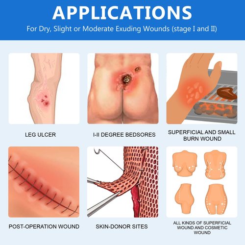 LotFancy Sacral Hydrocolloid Dressing, 6”x7”, Pack of 10, Sterile Thin Bordered Hydrocolloid Bandages, Sacrum Wound Gel Patches for Fast Healing, Water-Resistant, Individually Packed