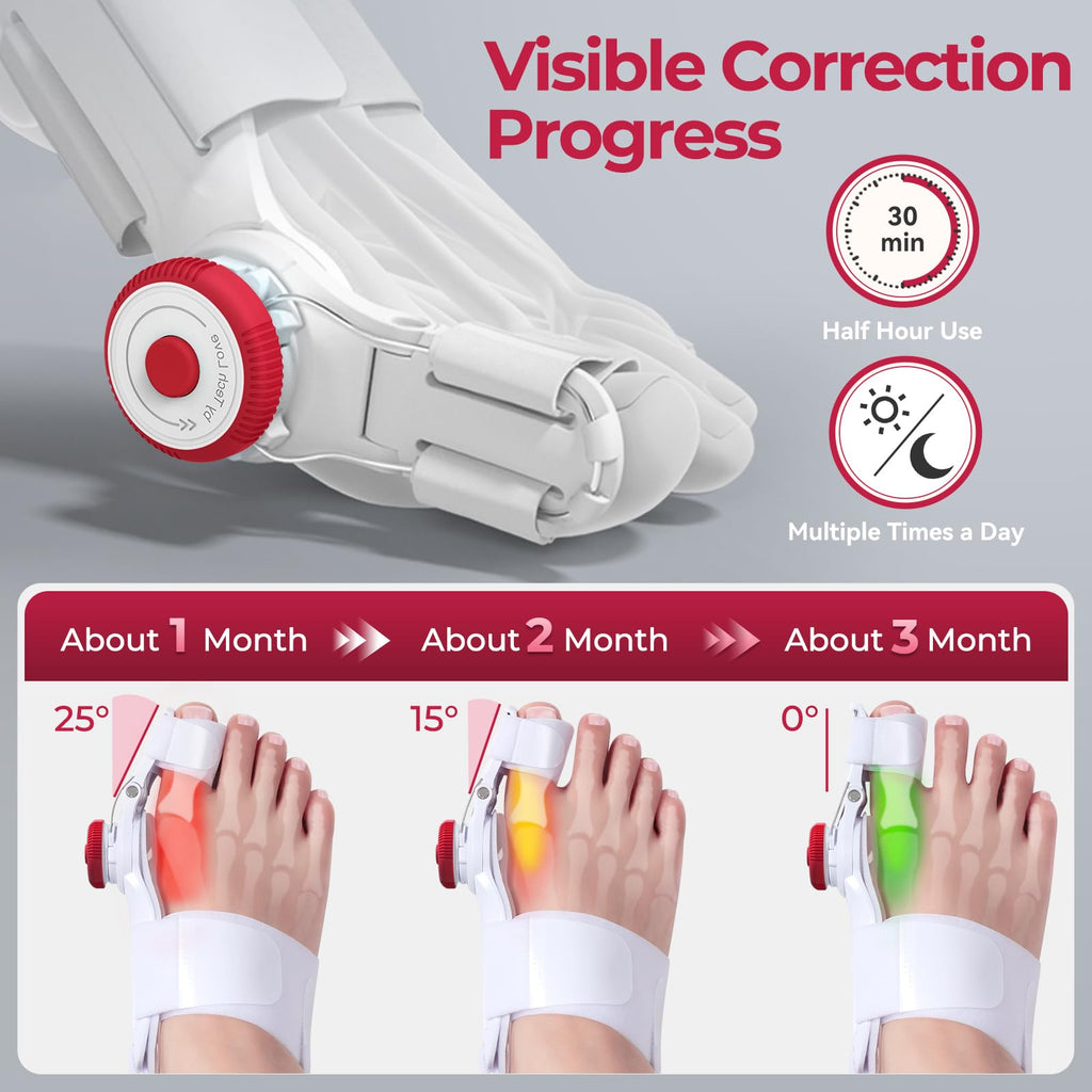 TENICORE Bunion Corrector for Kids, Adjustable Bunions Fix for Relief with Anti-slip Heel Strap, Red-1pc