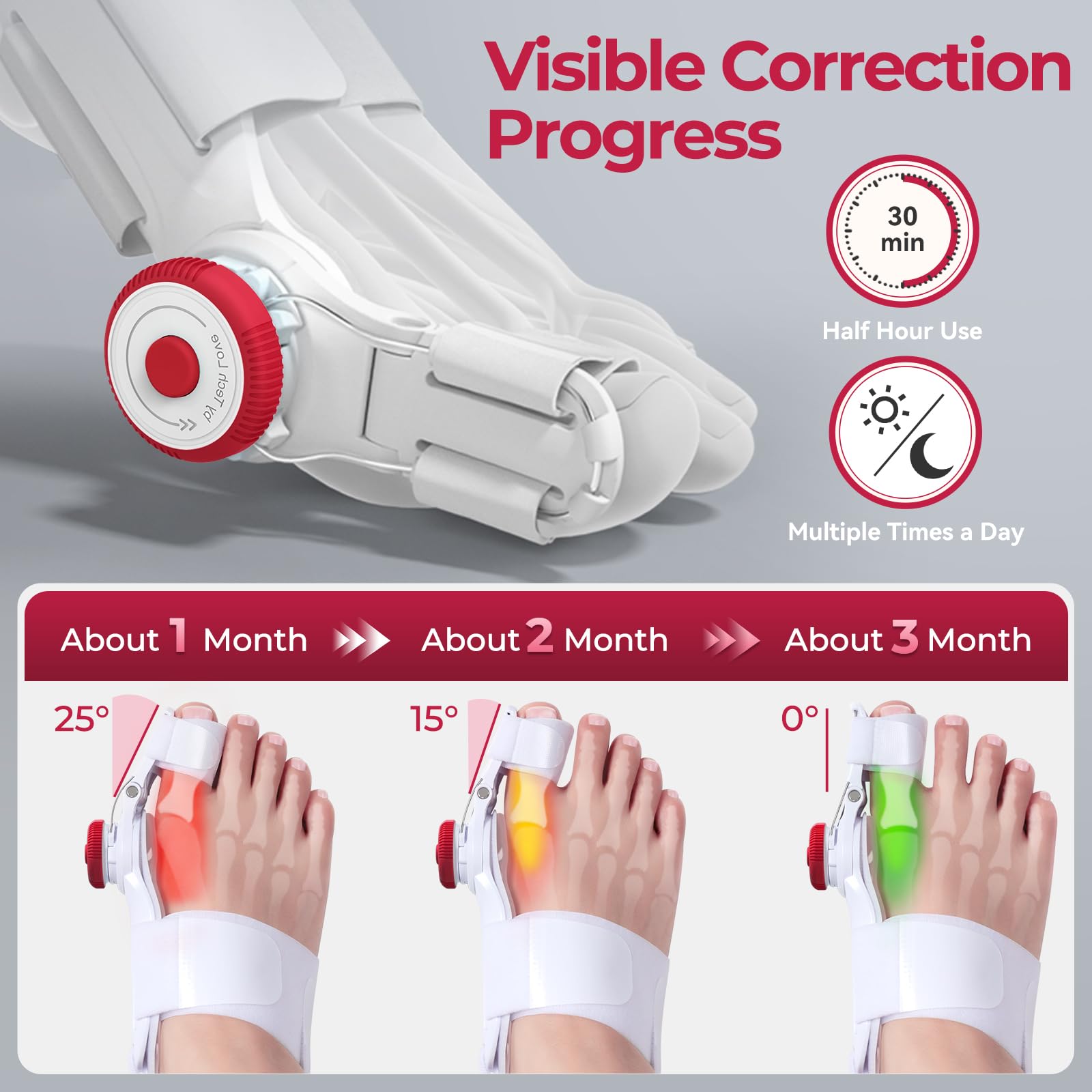 TENICORE Bunion Corrector for Kids, Adjustable Bunions Fix for Relief with Anti-slip Heel Strap, Red-1pc