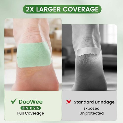 DooWee Aloe Vera Cracked Skin Patches - 50 Large Hydrating Bandages for Dry Heels & Hands | 3x2 Inch