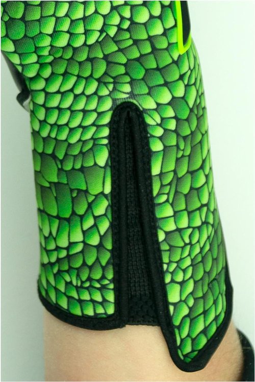 Reusch Venomous Gold X Goalkeeper Gloves, Size 9