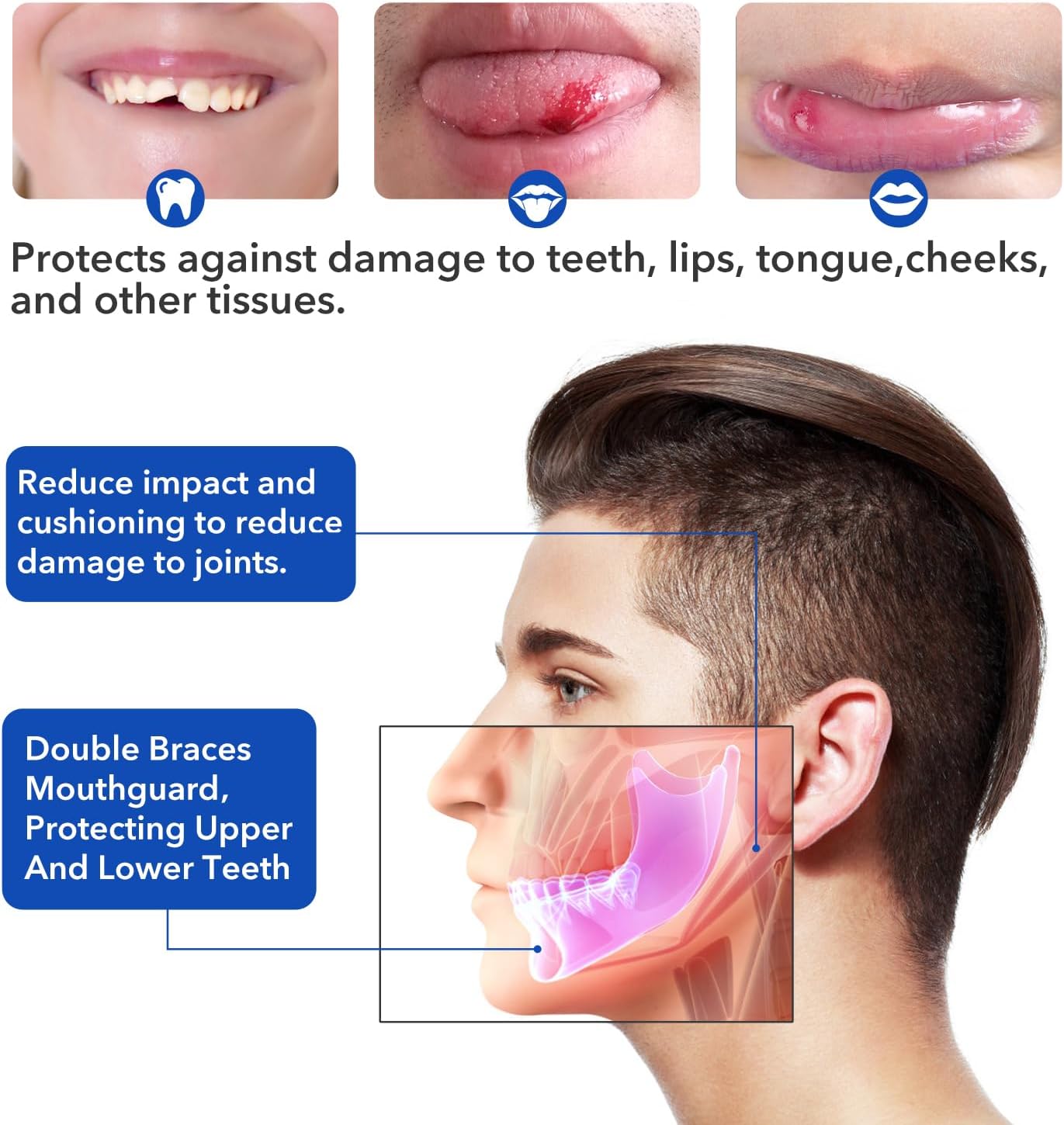 Skiennix Mouth Guard - Soft Sports Mouthguard for Braces | No Boiling Required, Ideal for Football & Martial Arts